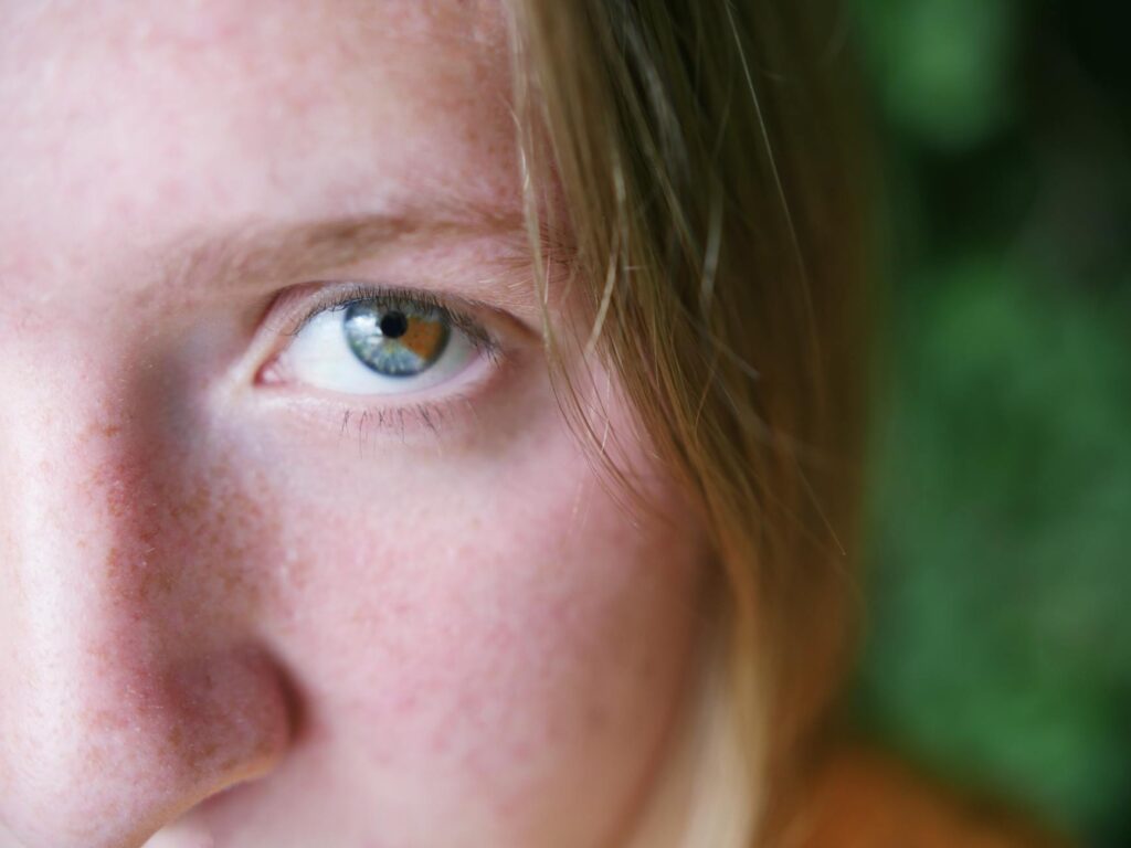 Щоки лущаться навесні — і крем тут ні до чого Зображення до статті від Tabitha Favor